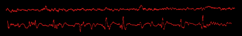 Brainwaves